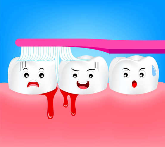 Chảy máu ở nướu răng